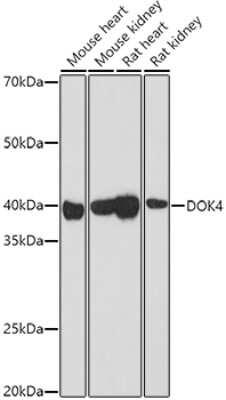 Western Blot: DOK4 AntibodyAzide and BSA Free [NBP2-92597]